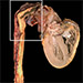 Aorta non-inflammatory